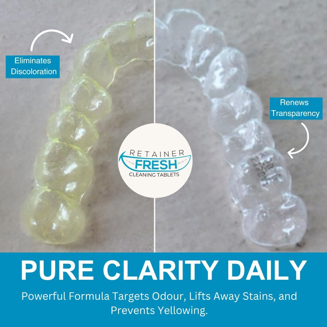 Retainer Cleaner Tablets - 36 Tablets 1 Month Retainer Fresh - Retainer Cleaning Tablets, Mouth Guard Cleaner, Denture Cleaner, Aligner Cleaner, Brite Retainer Tablets